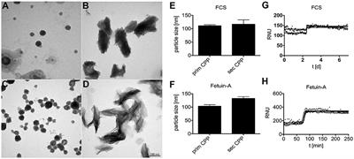 Cellular Clearance and Biological Activity of Calciprotein Particles Depend on Their Maturation State and Crystallinity